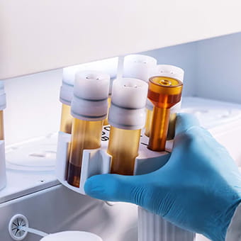 Automatisierte Probenvorbereitung