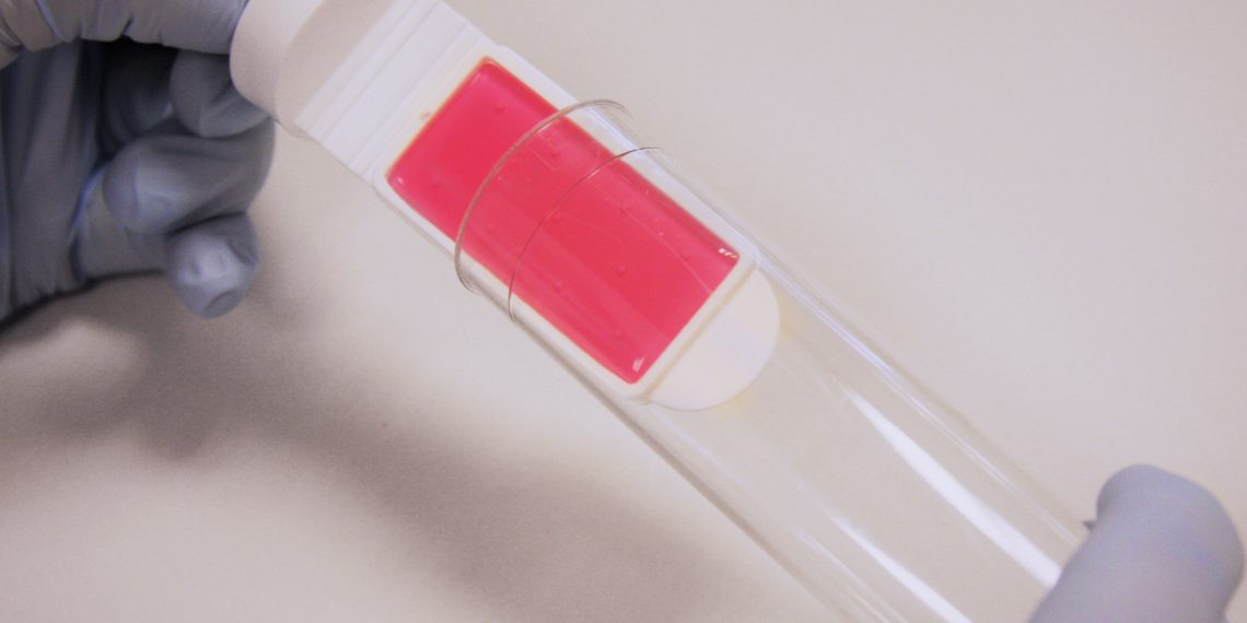 Mit Abklatschtests und Echtzeit-ATP-Testkits kann die Betriebshygiene überwacht werden, um Biozide gezielter und effizienter einzusetzen. Bild: Vink Chemicals