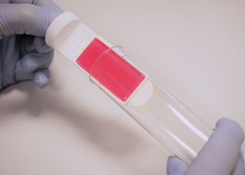 Mit Abklatschtests und Echtzeit-ATP-Testkits kann die Betriebshygiene überwacht werden, um Biozide gezielter und effizienter einzusetzen. Bild: Vink Chemicals